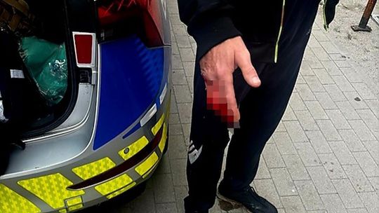 Bezskutecznie próbował zatamować krwawienie. Jego stan szybko się pogarszał