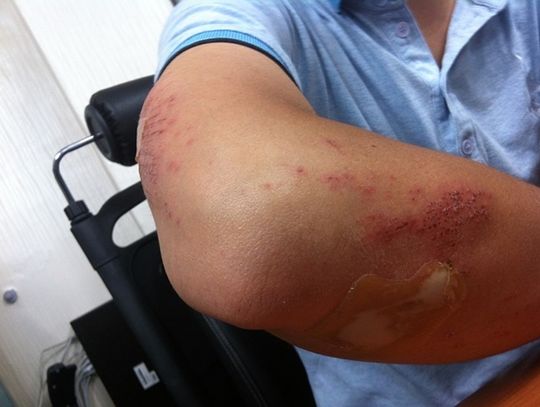 Ortopeda Warszawa - kiedy należy sięgnąć po jego pomoc?