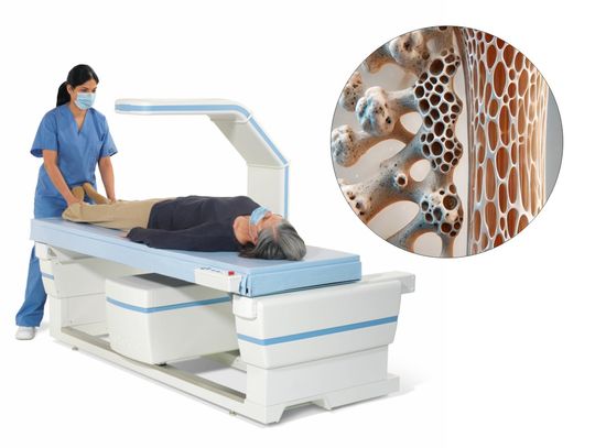 Badanie Osteoporozy w Oławie