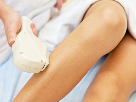 Epilacja laserowa – jak to działa?