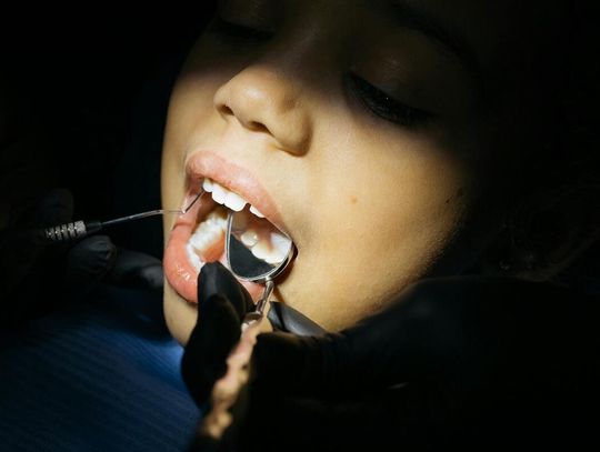 Leczenie zębów mlecznych – dlaczego warto zadbać o nie już od najmłodszych lat?