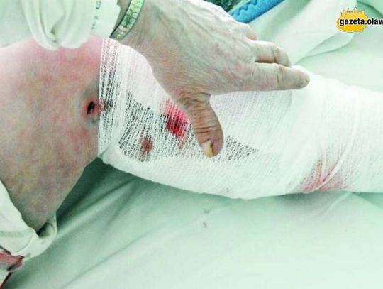 Psy gryzły pod szpitalem - jest wyrok