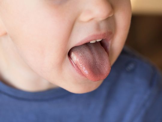 Rany na języku – skuteczne sposoby, jak je leczyć i uniknąć infekcji