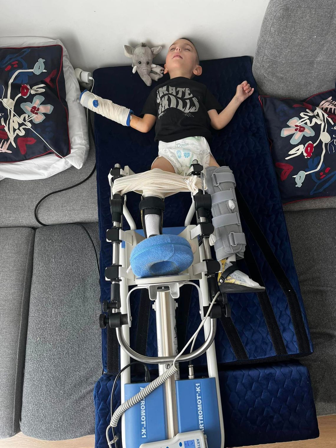 Mija trzecia doba po operacji Patryka - maleńkiego wojownika