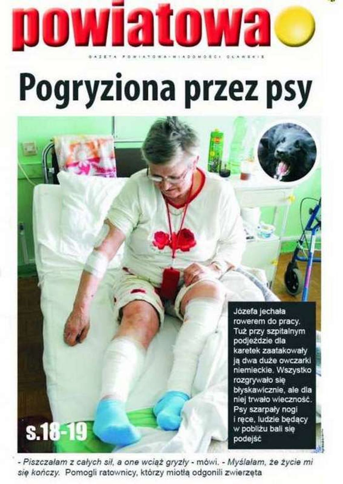 Psy atakowały kilka razy