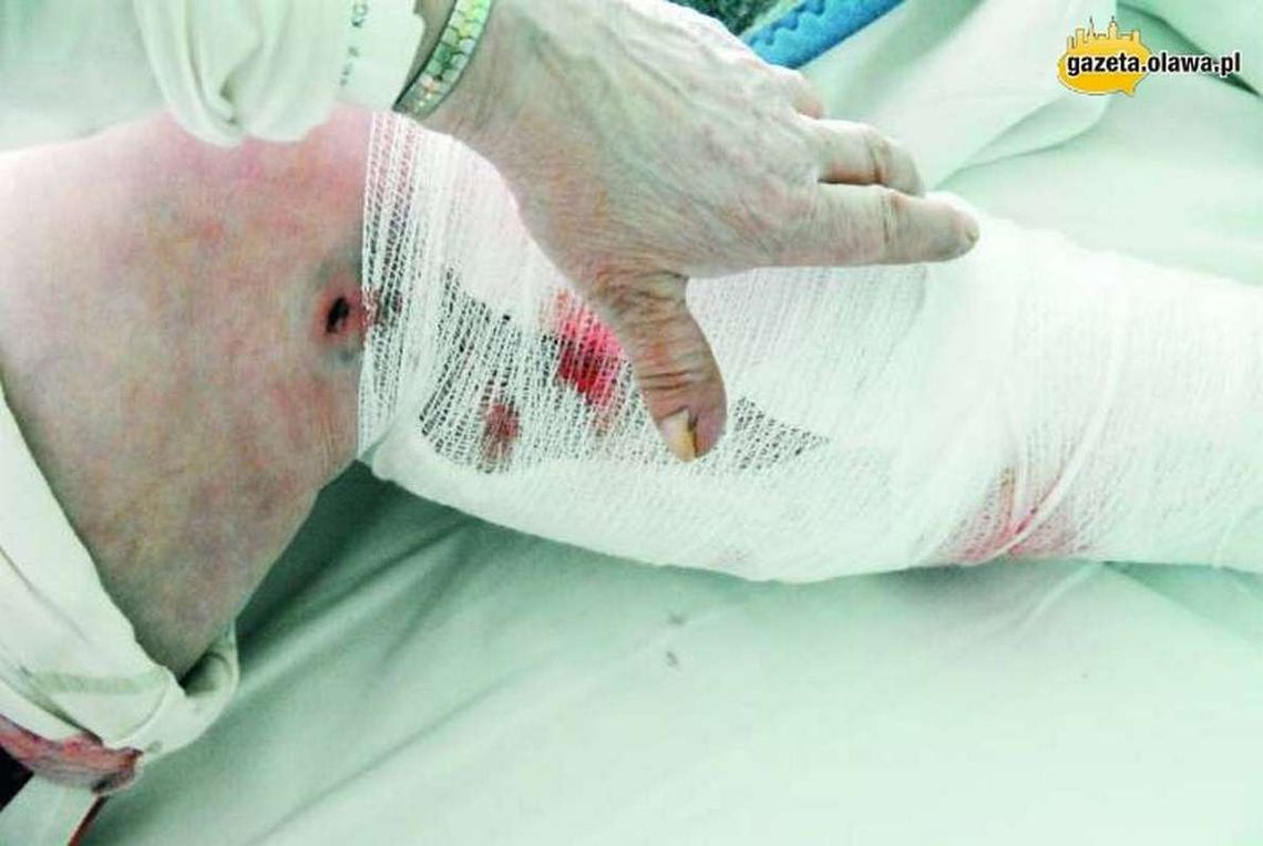 Psy gryzły pod szpitalem - jest wyrok Psy gryzły pod szpitalem - jest wyrok