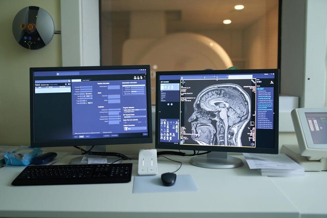 Rola wczesnej diagnostyki neurologicznej w zapobieganiu poważnym schorzeniom